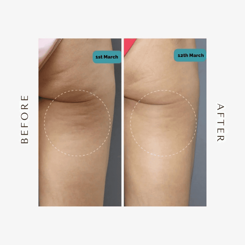 BelleFit™ 3D Anti-Cellulite Sculpting Leggings – Lift Effect & Tummy Control