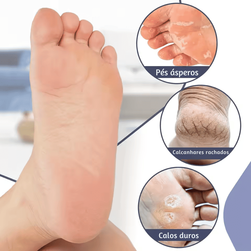 BelleCare – Meias Hidratantes Anti-Rachaduras para os Pés