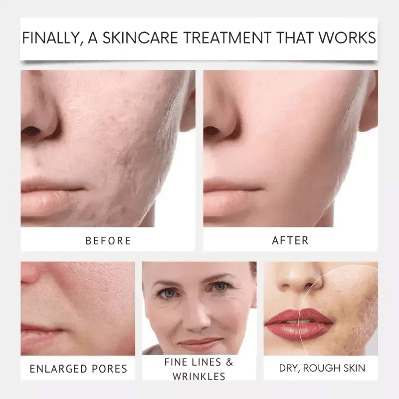 CollagenSkin™ – Anti-Ageing Lifting Mask