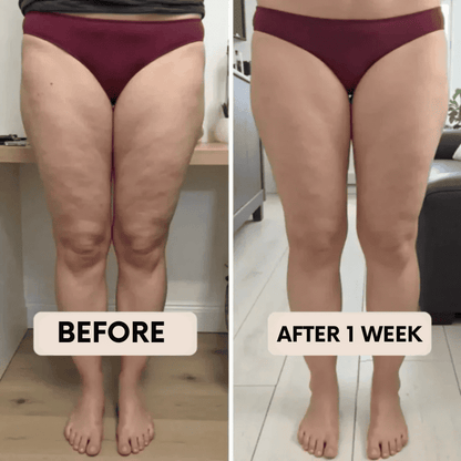 BelleFit™ 3D Anti-Cellulite Sculpting Leggings – Lift Effect & Tummy Control