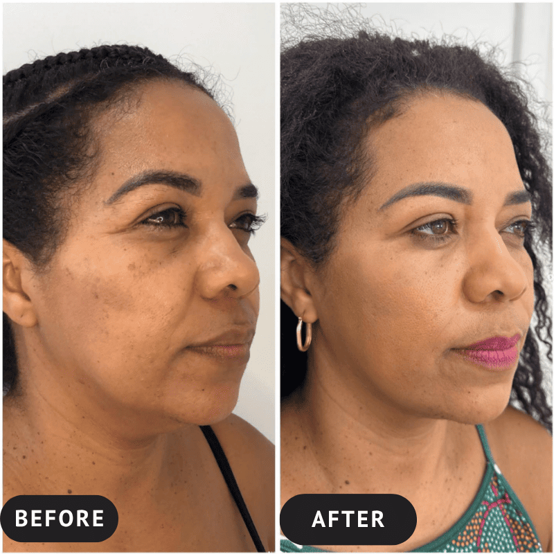 CollagenSkin™ – Anti-Ageing Lifting Mask